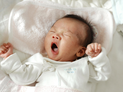 新生儿溶血症的症状 如何有效的预防新生儿溶血症