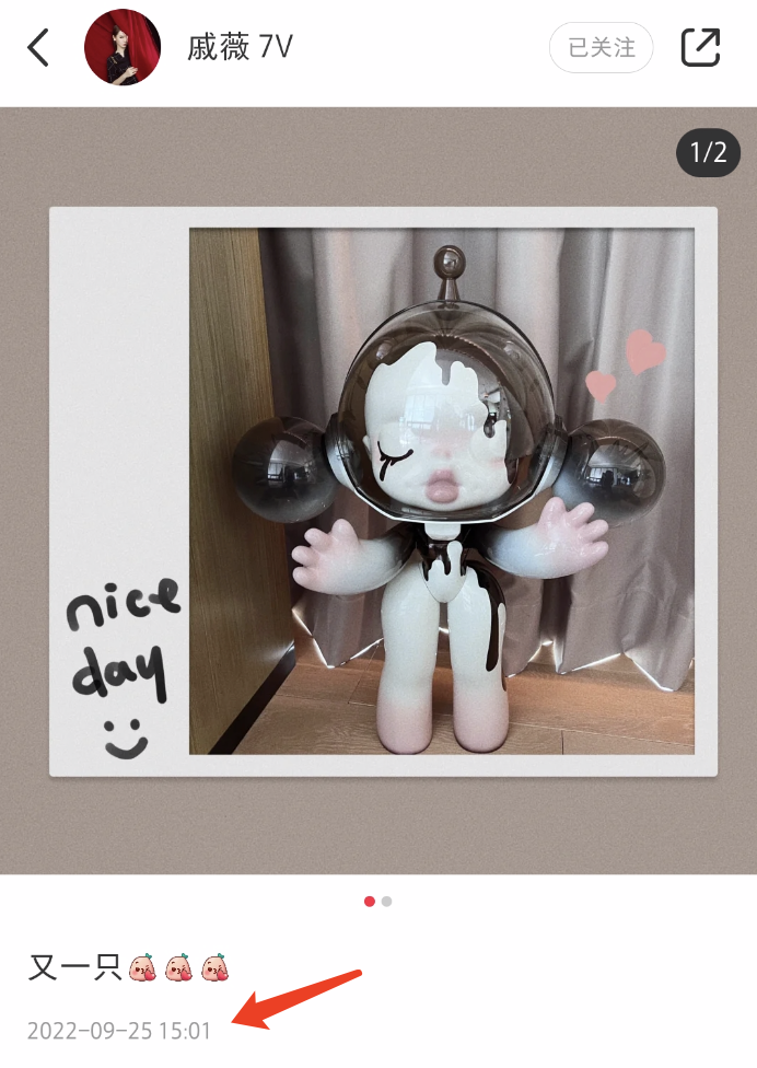 戚薇二胎产后未瘦至90斤压力大,脱发严重头皮抢镜,发际线上移