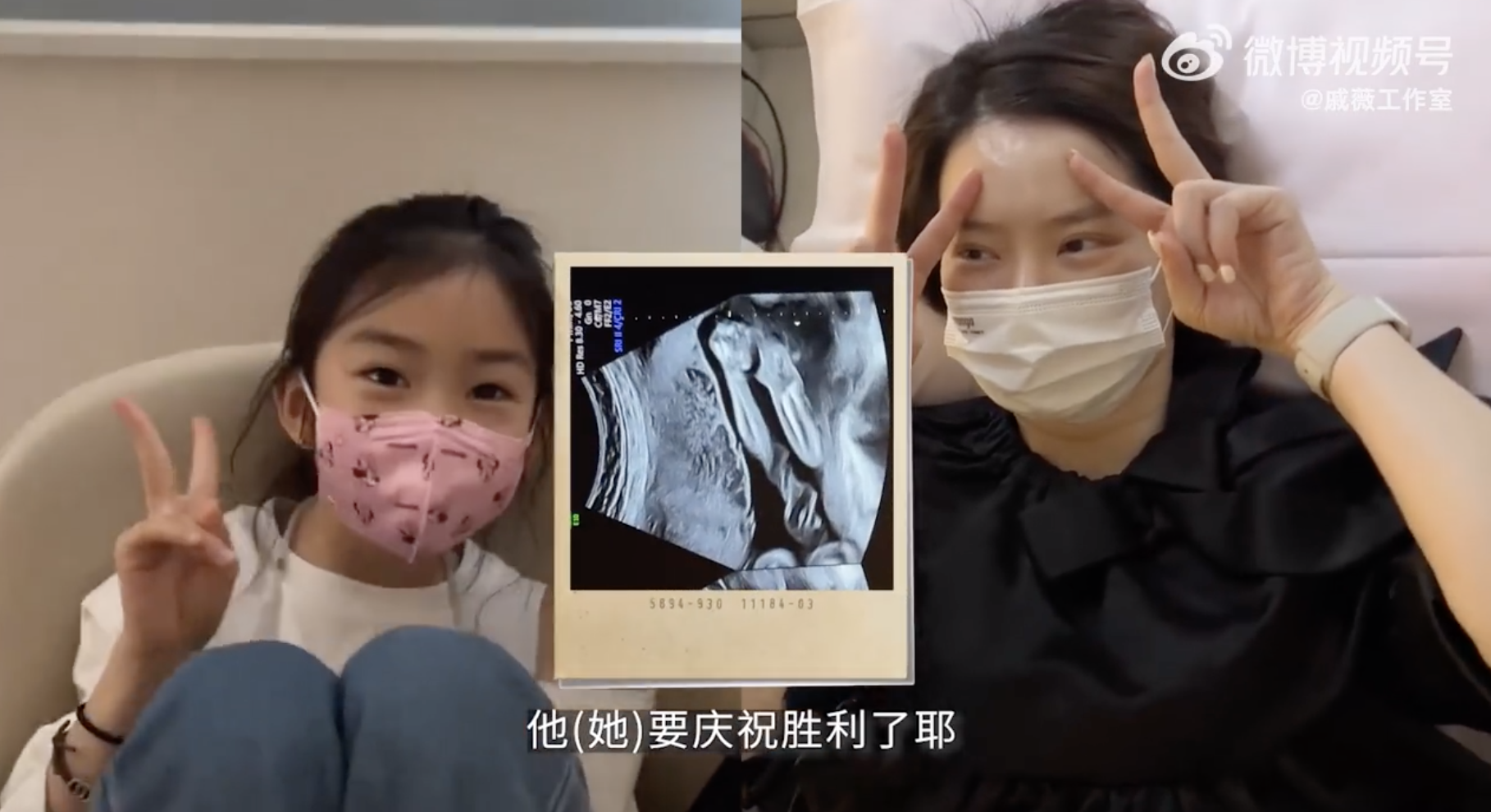 戚薇二胎产后未瘦至90斤压力大,脱发严重头皮抢镜,发际线上移