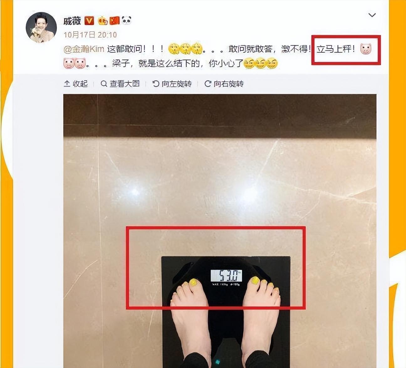 戚薇二胎产后未瘦至90斤压力大,脱发严重头皮抢镜,发际线上移