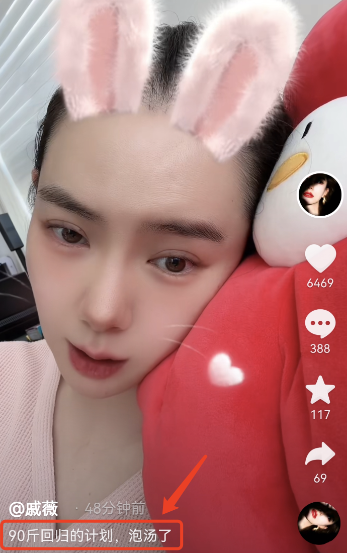 戚薇二胎产后未瘦至90斤压力大,脱发严重头皮抢镜,发际线上移