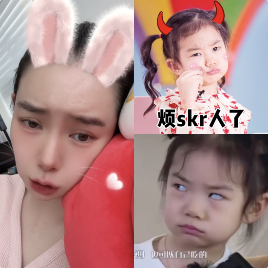 戚薇二胎产后未瘦至90斤压力大,脱发严重头皮抢镜,发际线上移