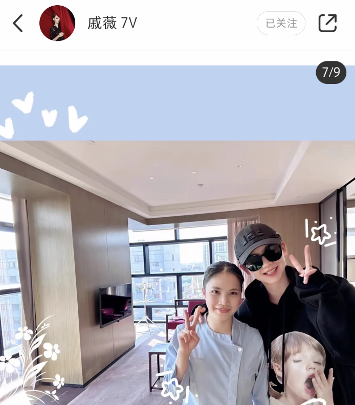 戚薇二胎产后未瘦至90斤压力大,脱发严重头皮抢镜,发际线上移