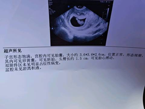 b超显示三条线表示怀的是女孩子吗.jpg b超显示三条线表示怀的是女孩子吗.jpg