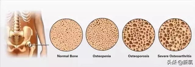 宋茜三瓶盖水事件过程(宋茜3口喝掉大杯饮料极度危害健康)