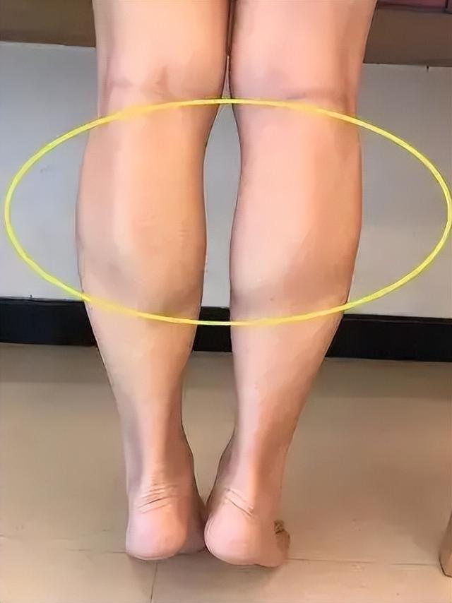 刘涛体重竟然飙到120斤（刘涛跑步消水肿）(4)