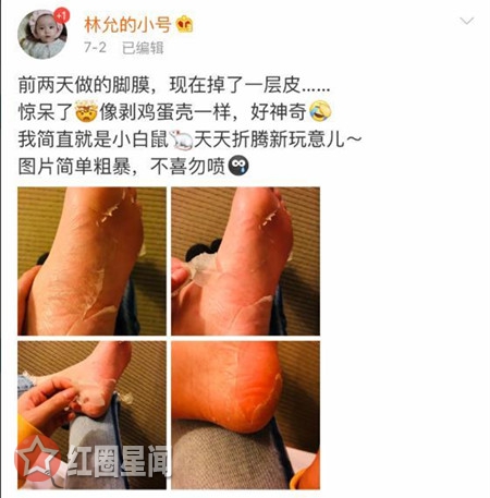 林允回应公开撕脚皮 耿直回怼明星也是人